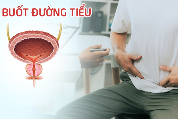 Buốt đường tiểu – Nguyên nhân và cách khắc phục hiệu quả