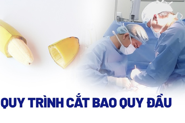 Khi nào nam giới nên cắt bao quy đầu? Các bước cắt bao quy đầu an toàn