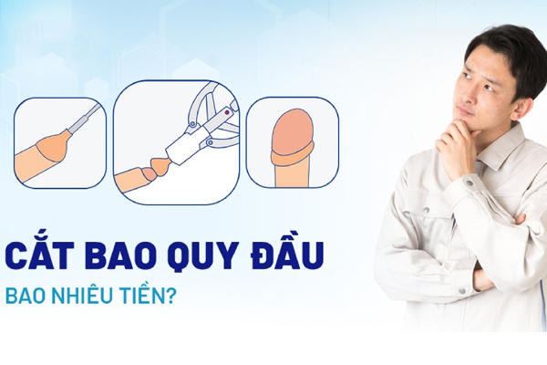 Chi phí cắt bao quy đầu ở bệnh viện bao nhiêu? Cập nhật bảng giá mới
