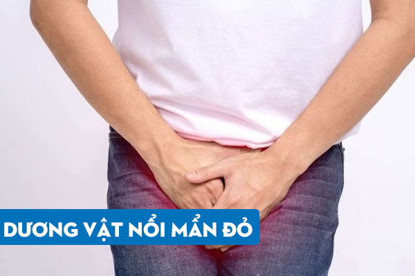 Dương vật nổi mẩn đỏ – Triệu chứng không nên chủ quan