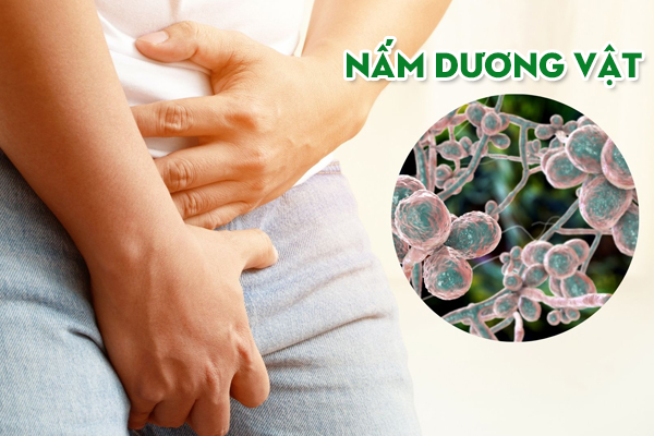 Nấm dương vật – Nguyên nhân, dấu hiệu và cách chữa trị