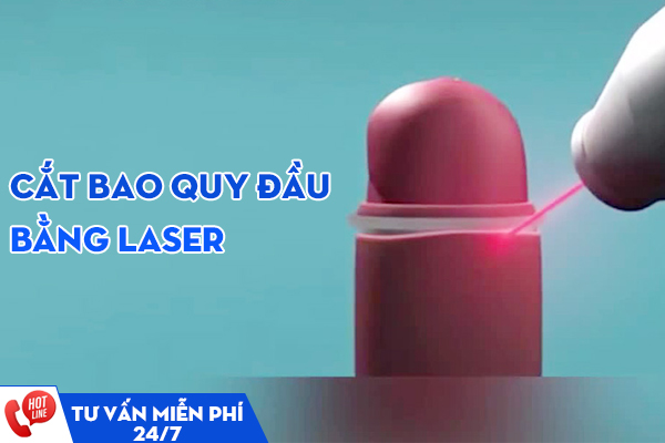 Cắt bao quy đầu Laser – Ưu điểm, quy trình và chi phí thực hiện