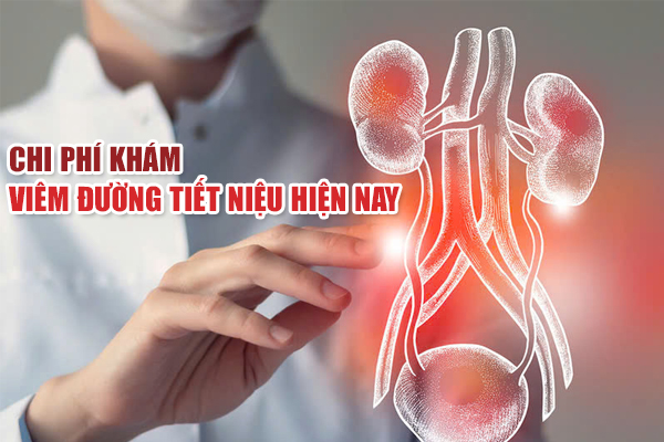 Chi phí khám viêm đường tiết niệu hết bao nhiêu? Thông tin chính xác từ bác sĩ