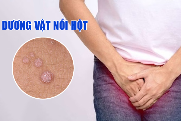 Dương vật nổi hột là do đâu? Có tự hết không?