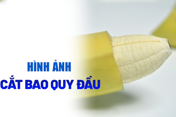 Hình ảnh cắt bao quy đầu trước và sau khi thực hiện