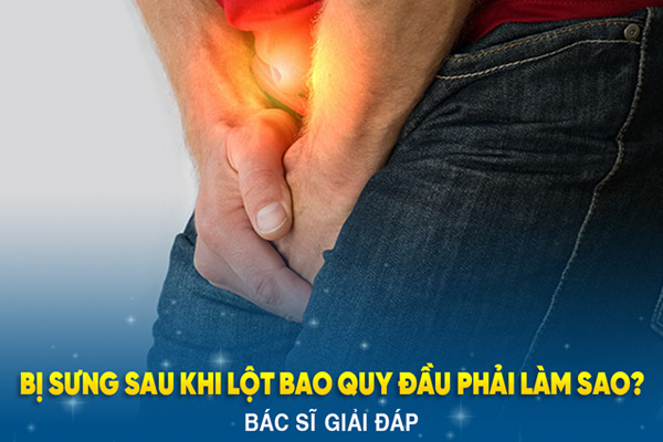 Lột bao quy đầu bị sưng – Nguyên nhân và cách giảm sưng nhanh