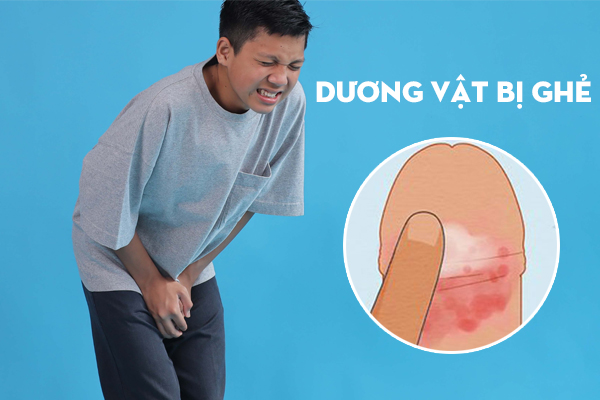 Dương vật bị ghẻ lở – Nguyên nhân và cách khắc phục hiệu quả, nhanh khỏi