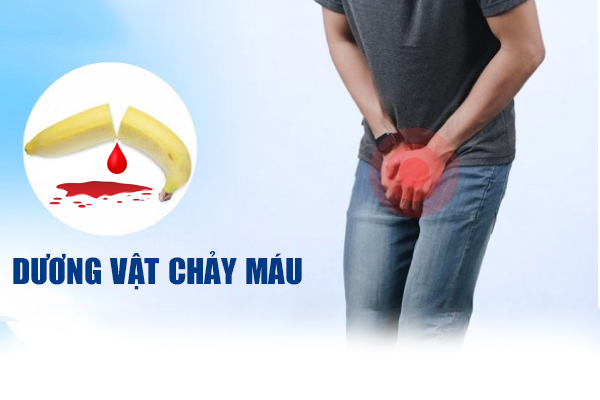 Dương vật chảy máu – Nguyên nhân và cách xử lý an toàn