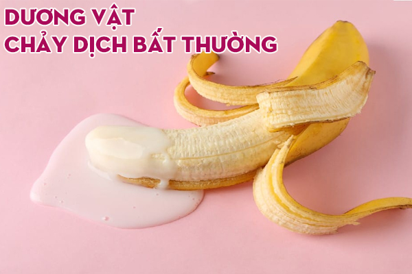 Dương vật chảy dịch bất thường – Nguyên nhân và cách khắc phục
