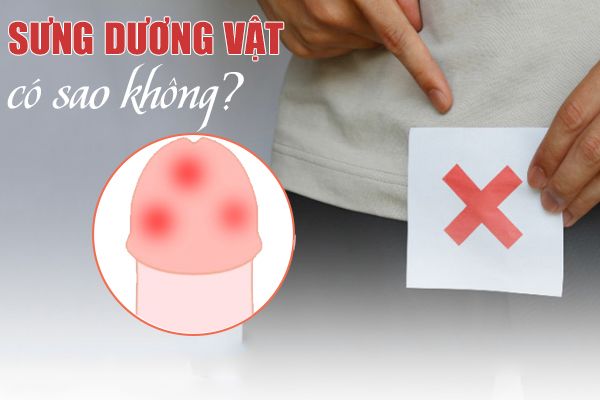 Sưng dương vật – Nguyên nhân và cách chữa trị hiệu quả, nhanh khỏi